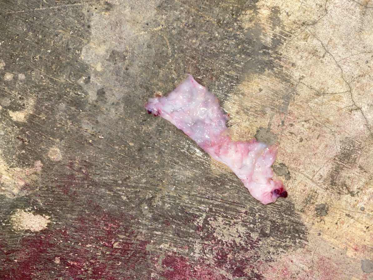 แบบนี้เรียกว่าแท้งมั้ยคะ