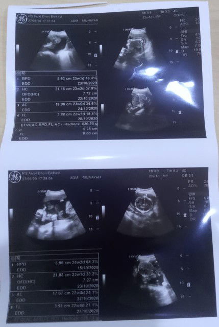 Berbagi kebahagiaan...