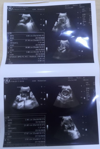 Berbagi kebahagiaan...