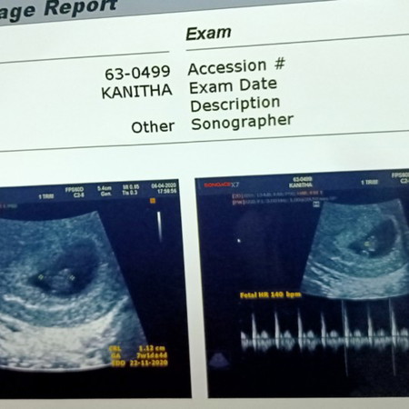 เป็นคุณแม่ยุคโควิดต้องสตรองขนาดไหนกัน
