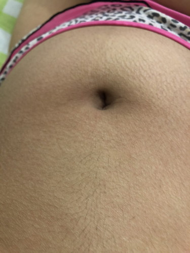 Ada ga perutnya yg sperti ini usia 6 jalan selulit diksh apa ya? Kok parah banget itu kelihatannya seramm .. bio oil baguskah? Atau palmers cocoa ?