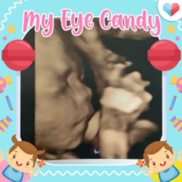 เด็กน้อย24w 6d