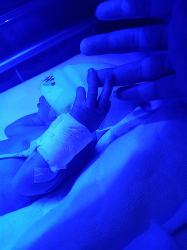 น้องพอตเตอร์