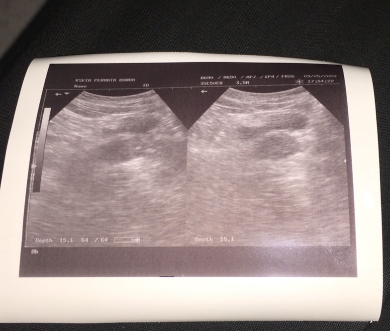 Di USG belum keluhatan