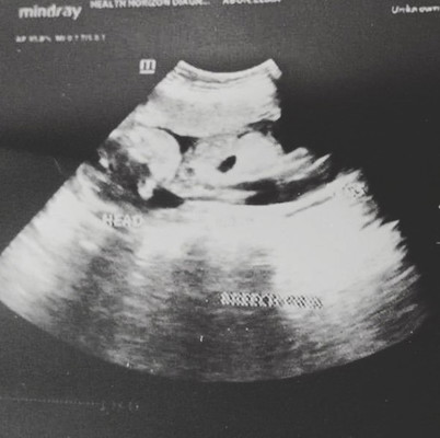 19weeks