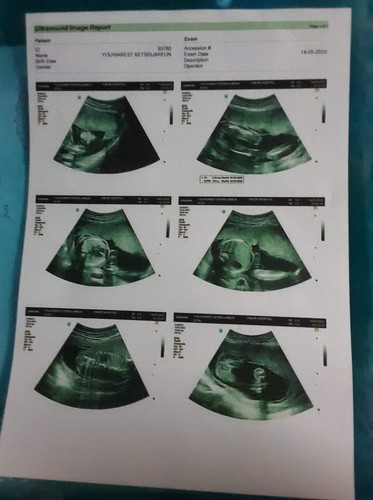 ดวงใจของพ่อ แม่?❤️