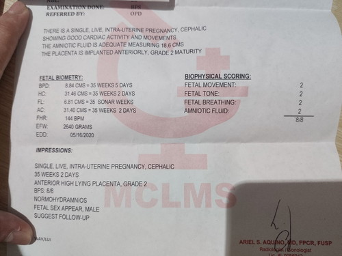 33 weeks and 6 days pero bat ganun