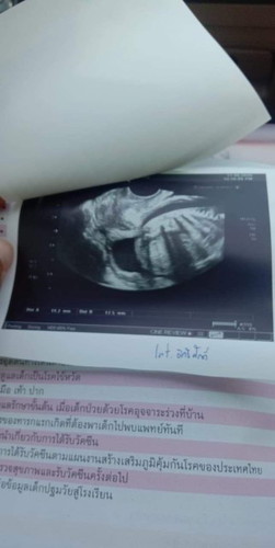 อยากรู้ว่าได้ ผ.ช หรือ ผ.ญ ค้ะ