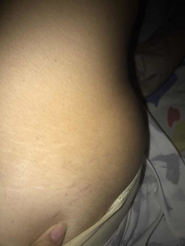 21w5d รอยแตกกก!