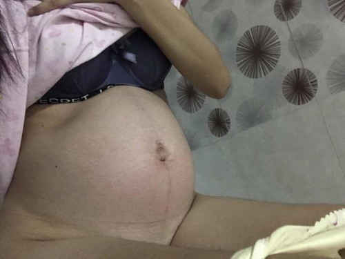 ท้องผูกกกกก😪😥