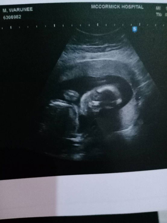 Keropii Love Kt profile icon