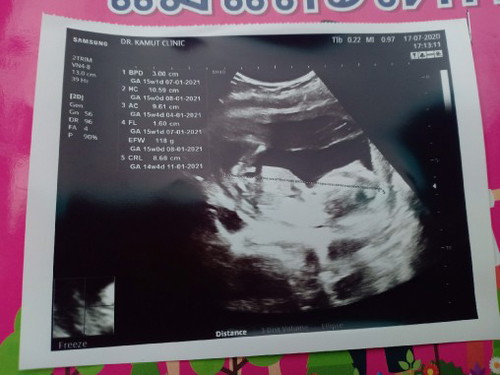 ขอดูภาพหน่อยจ้าแม่ๆๆ