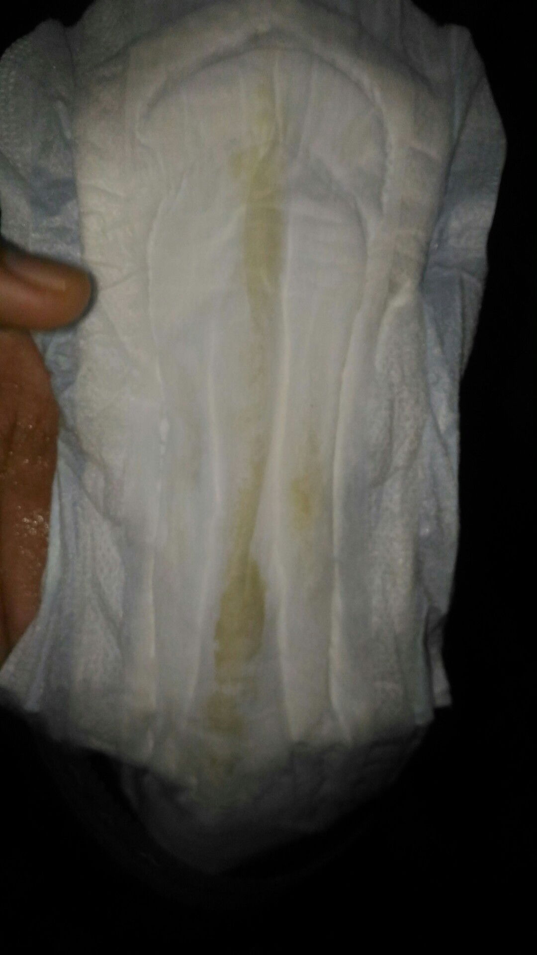 keputihan setelah melahirkan