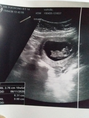 keliru tentang gambar scan