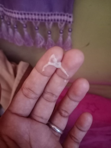 ตกขาวหรือมูกคะ