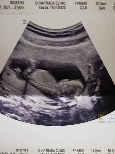 13w 3d