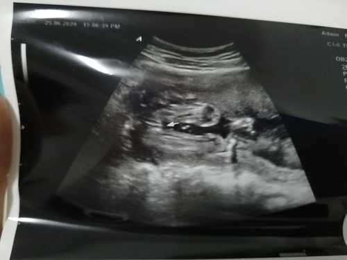ได้ลูกสาว