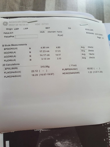5เดือน ไปซาว์ด ลุ้นเพศลูกสุดๆ สุดท้ายตอนไปซาว์ดน้องหันตูดให้หมอ เลย อดเห็นเพศเลย หมอได้แต่สันนิษฐานว่าเป็นหญิง แม่ก็อ่านภาษาหมอไม่รุ้ด้วยซี ถามหมอนิดหน่อยก็ด่า แม่แทบไม่กล้าถามไรหมอเลย55