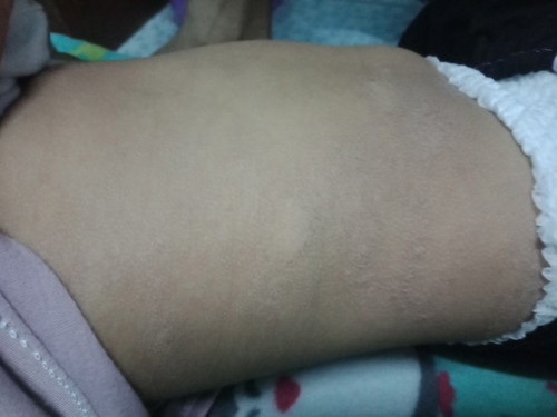 มีลูกบ้านไหนเป็นแบบนี้บ้างค่ะ