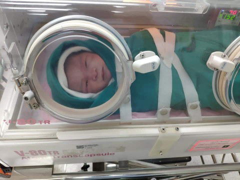 เกินกำหนดคลอด  40+2week  ท้องสาม