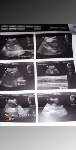 sino po marunong tumingin ng ultrasound