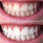 Whitening toothpaste