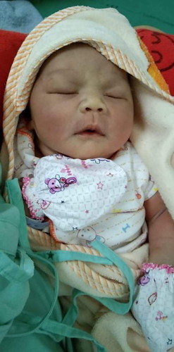 แตกแร้วจ้า 40+4week