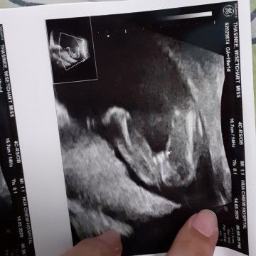 คุณแม่เลี้ยงเดี่ยวอยากได้ลูกสาว