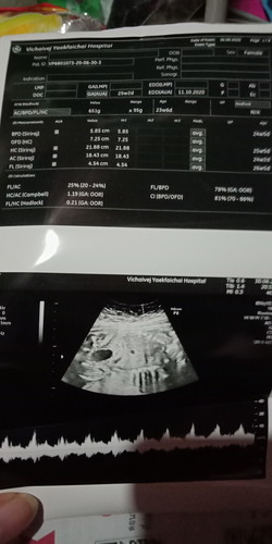 มองไม่ออกเลยค่ะว่าเพศอะไร