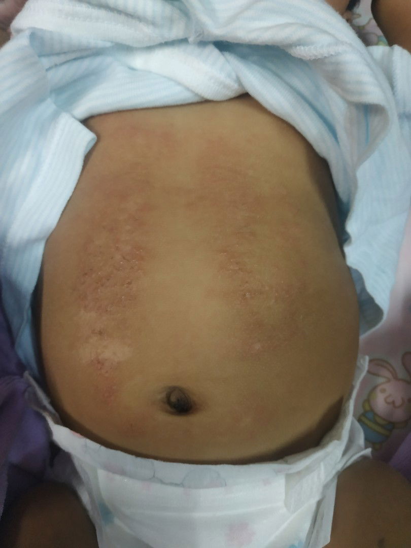 อยากสอบถามค่ารักษา รพ.เด็กเบื้องต้น