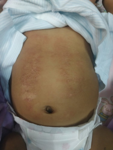 อยากสอบถามค่ารักษา รพ.เด็กเบื้องต้น