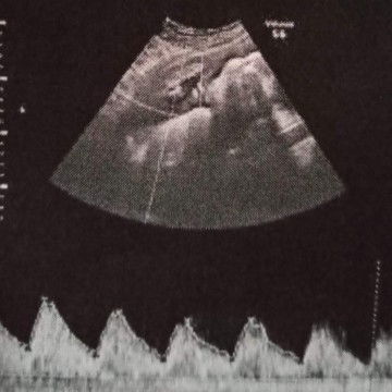 ตั้งครรภ์