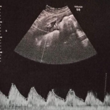 ตั้งครรภ์