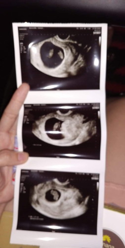 เรื่องสุดเศร้าของวันนี้