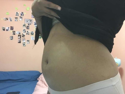 18w5d