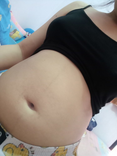 ตุ้มขึ้นบนท้องเปนรัยไม่