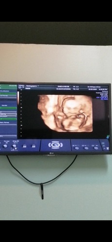 ซาวด์ 4 มิติ