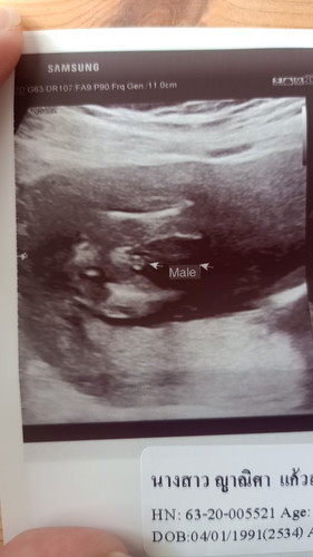 บอย หรือ เกิร์ล น้าาา