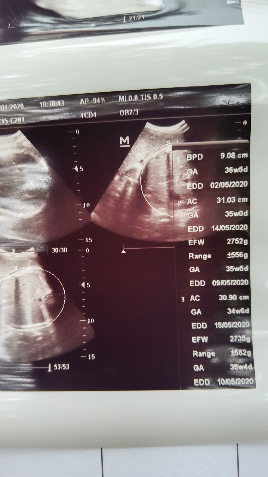 bolehkah makan buah nanas di usia kehamilan 38 minggu?