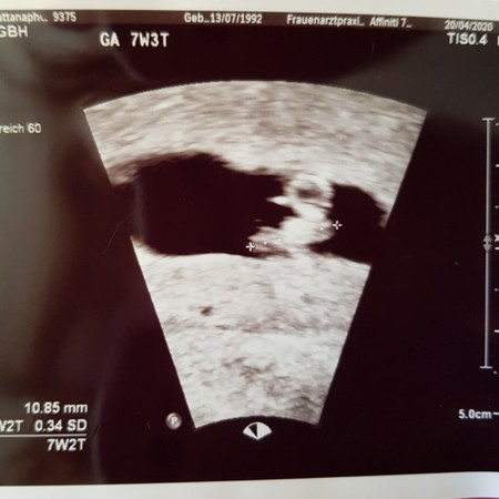 สอบถามแม่ๆ