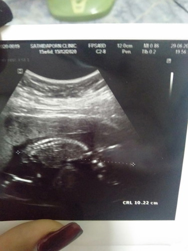 ลูกนอนคว่ำ