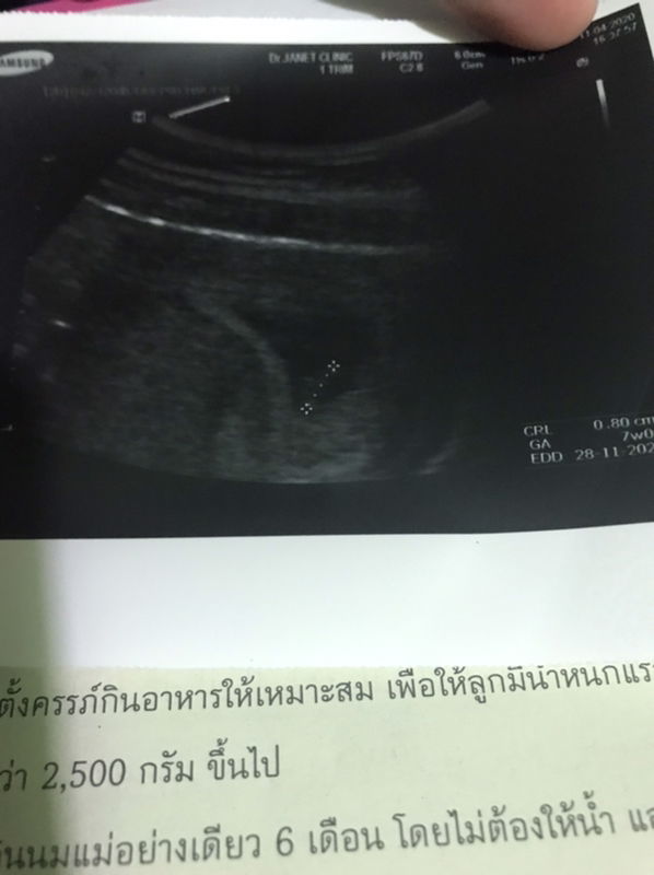 Sunisa Su profile icon