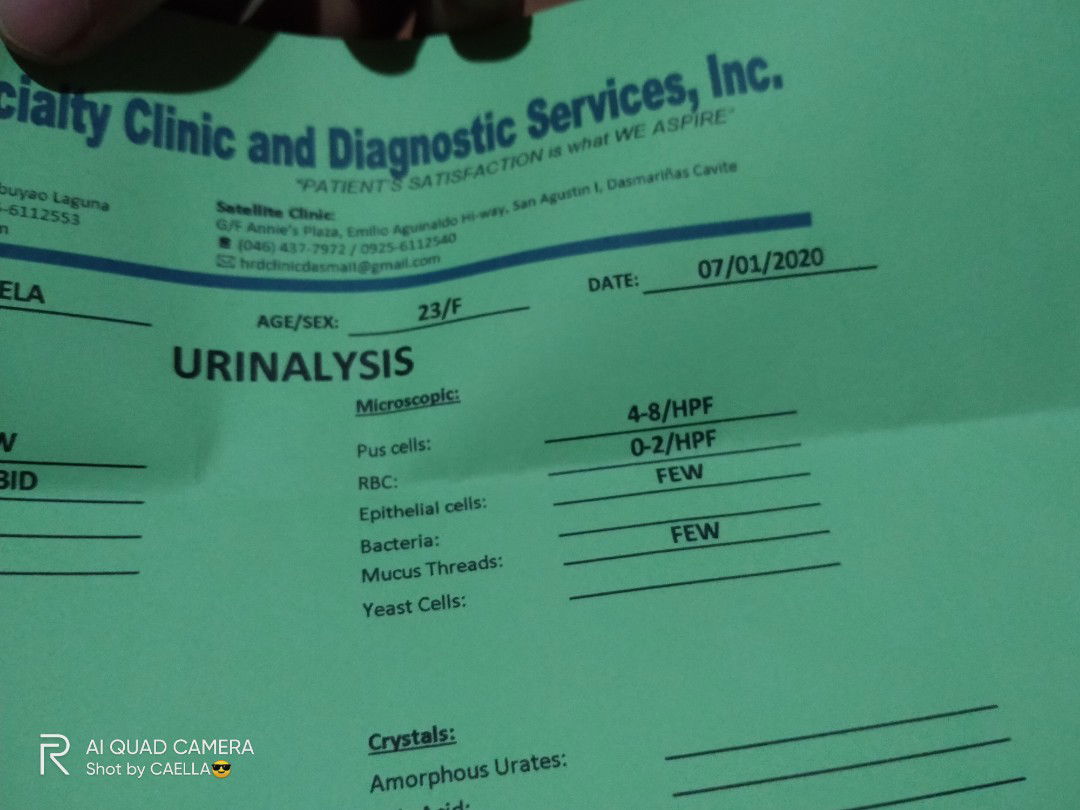 URINALYSIS