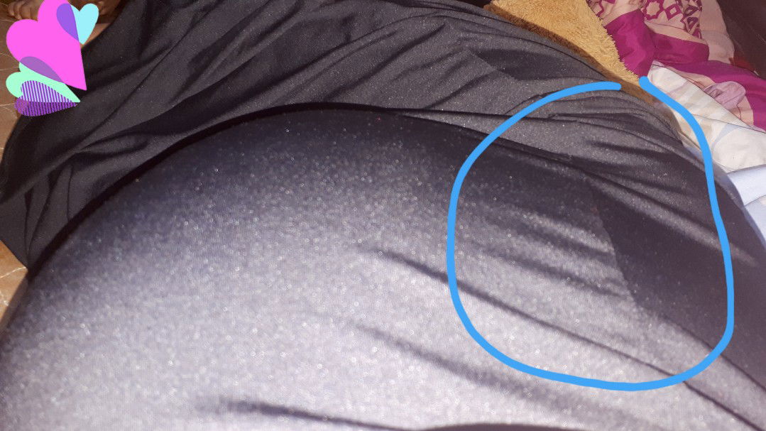 Gerakan baby dominan di pinggir (37 week)