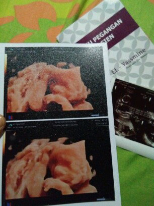 Cerita sama bby