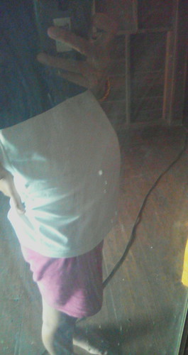 ท้องเล็ก