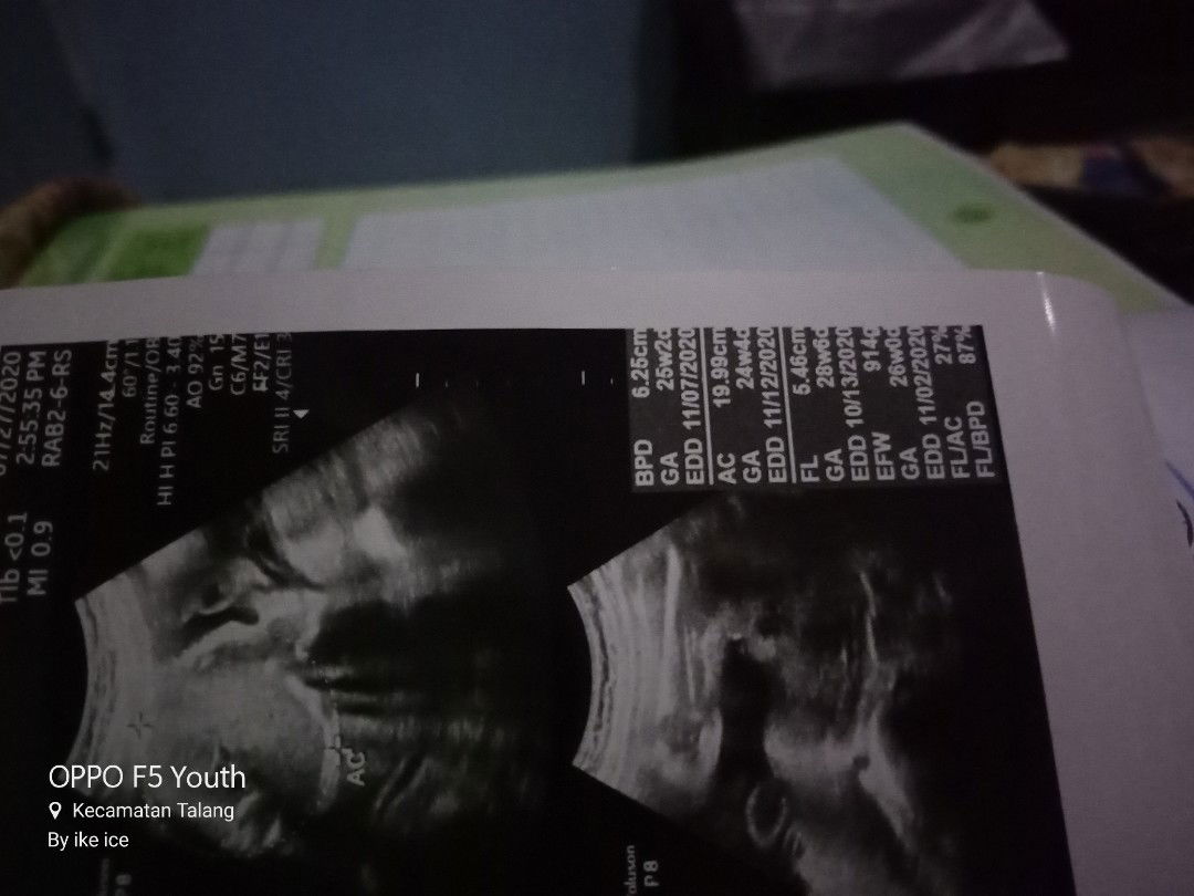 Ada yg bisa baca hasil usg gak bun?