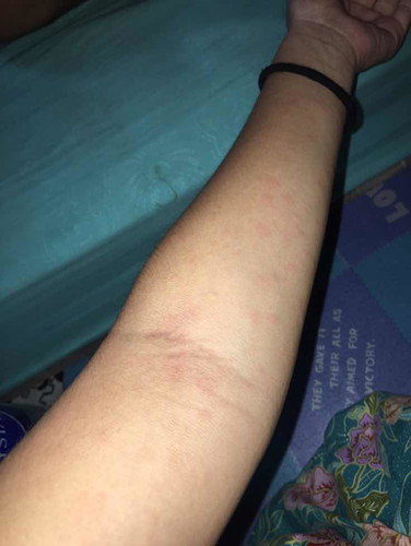 แม่ๆคนไหนเป็นแบบนี้บ้างค่ะมันอัตรายมั้ย