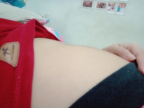 เลือดออก