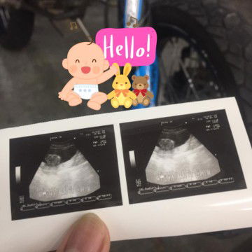 Lusiana profile icon